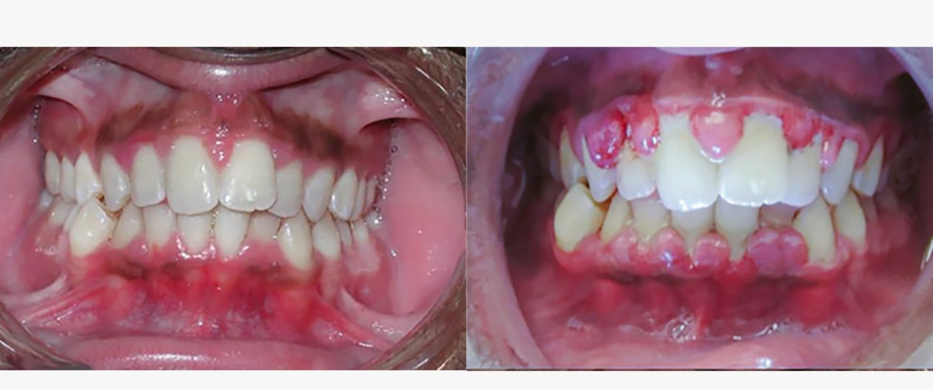 The Importance of Anesthesia in Debridement Procedures