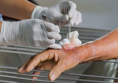 Debridement Pain: What to Expect and How to Manage It