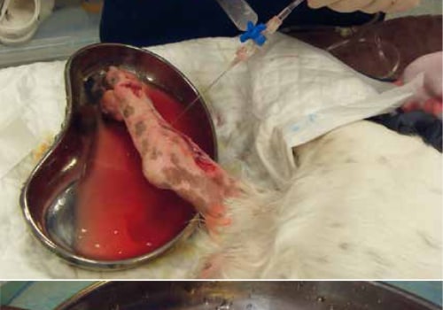 The Importance of Anesthesia in Wound Debridement